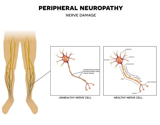 red infrared light therapy for neuropathy