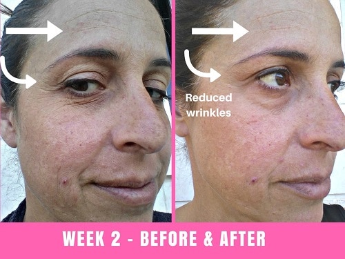 face slimming mask before and after 3 days