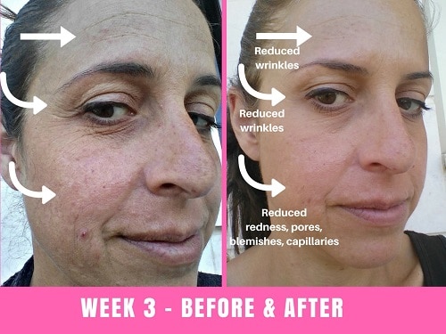 face slimming mask before and after 8 time