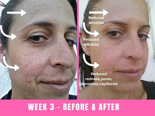 face slimming mask before and after 8 time