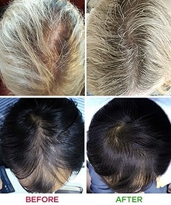 irestore before and after