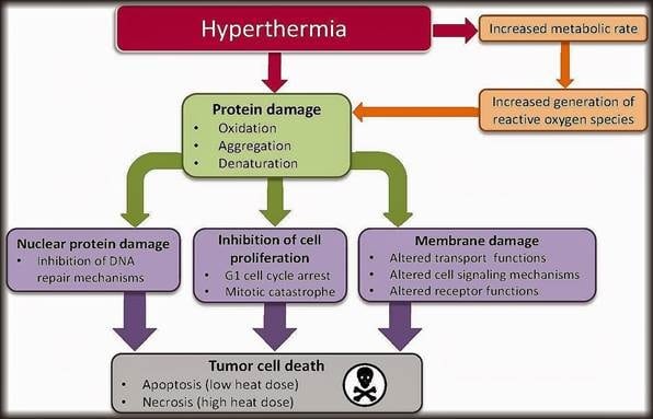 hyperthermia for cancer