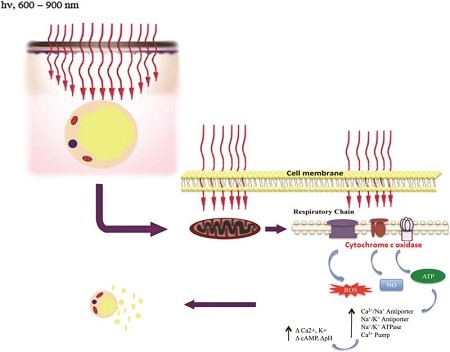 red light therapy before and after cellulite