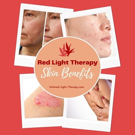 red light therapy for the skin