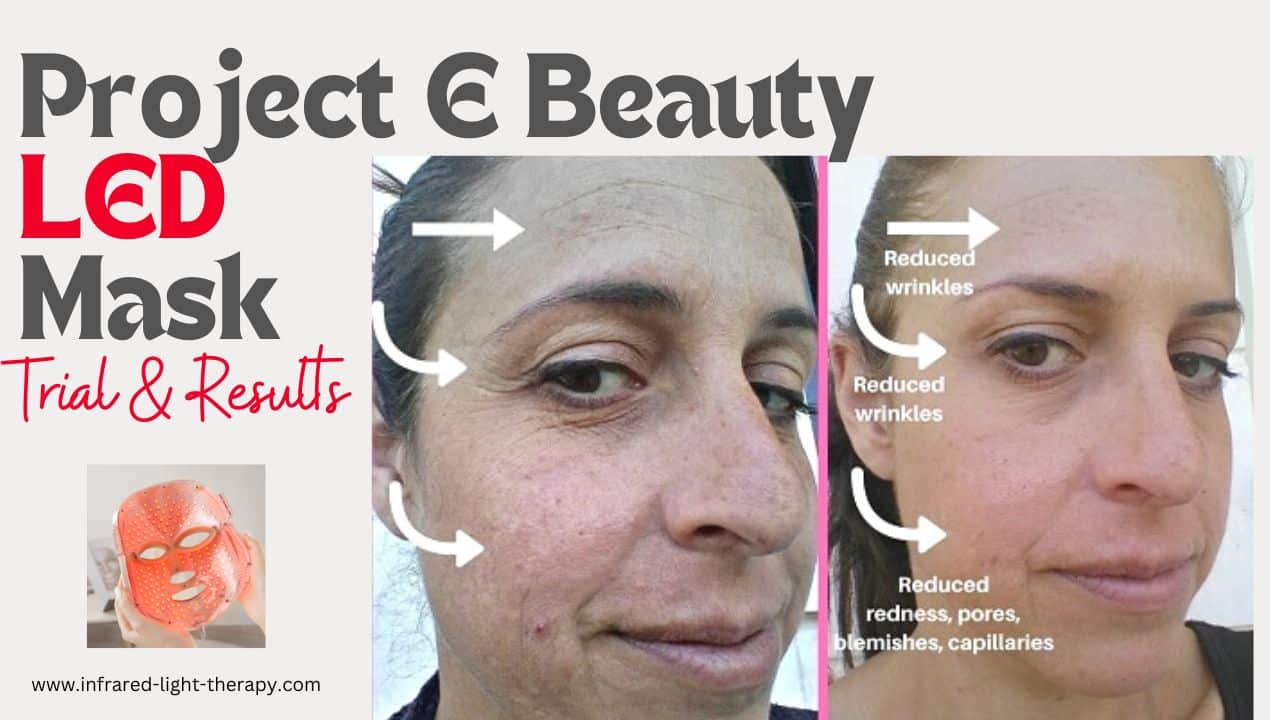 Project E Beauty LED Face Mask Before and After (30 Days)