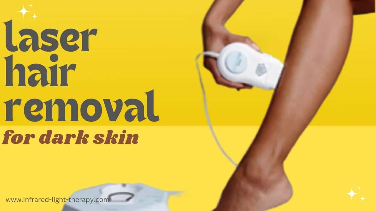 IPL devices for dark skin