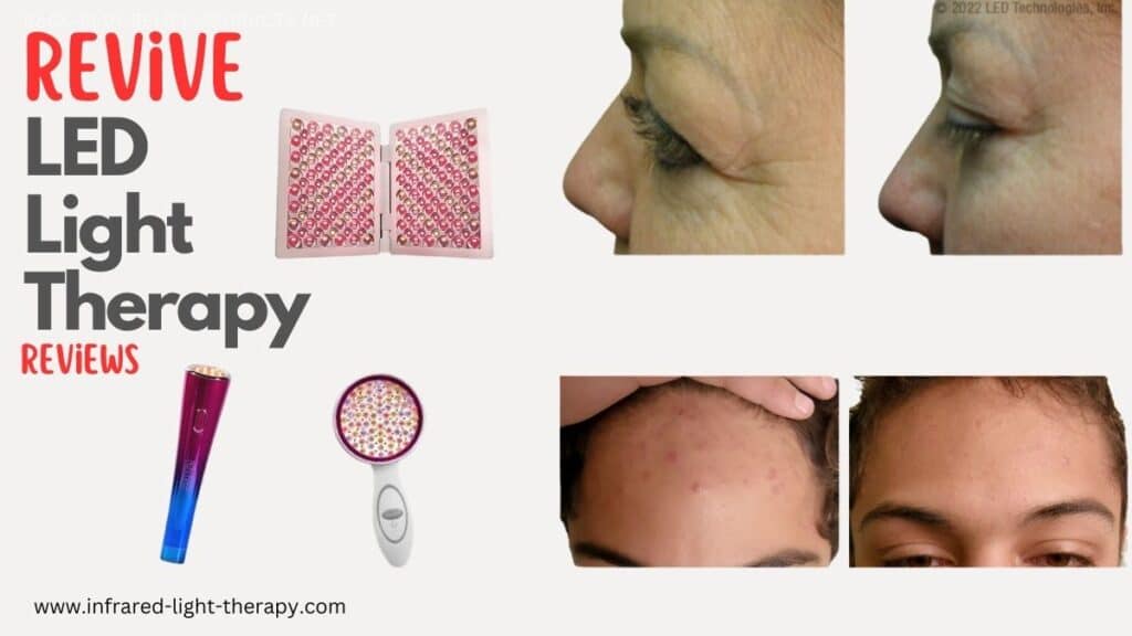 Revive (dpl) Light Therapy Reviews (Plus Before & After)