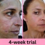 red light therapy before and after