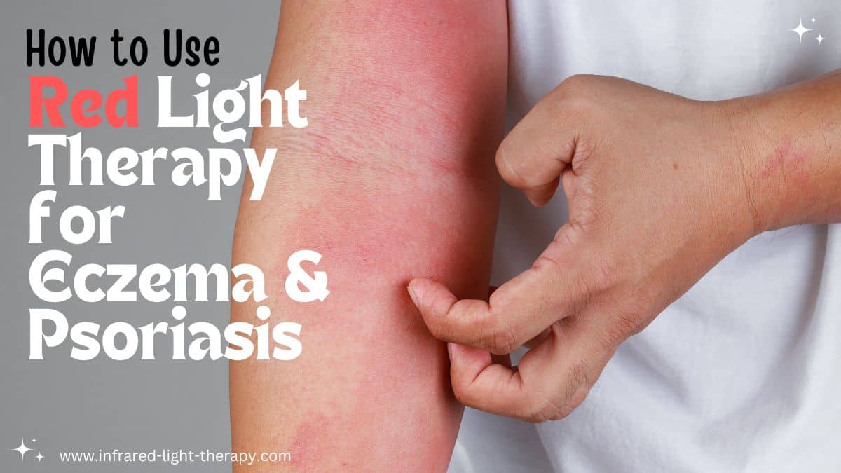 red light therapy for eczema psoriasis at home