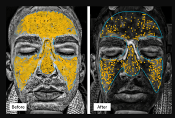 omnilux men clinical study results
